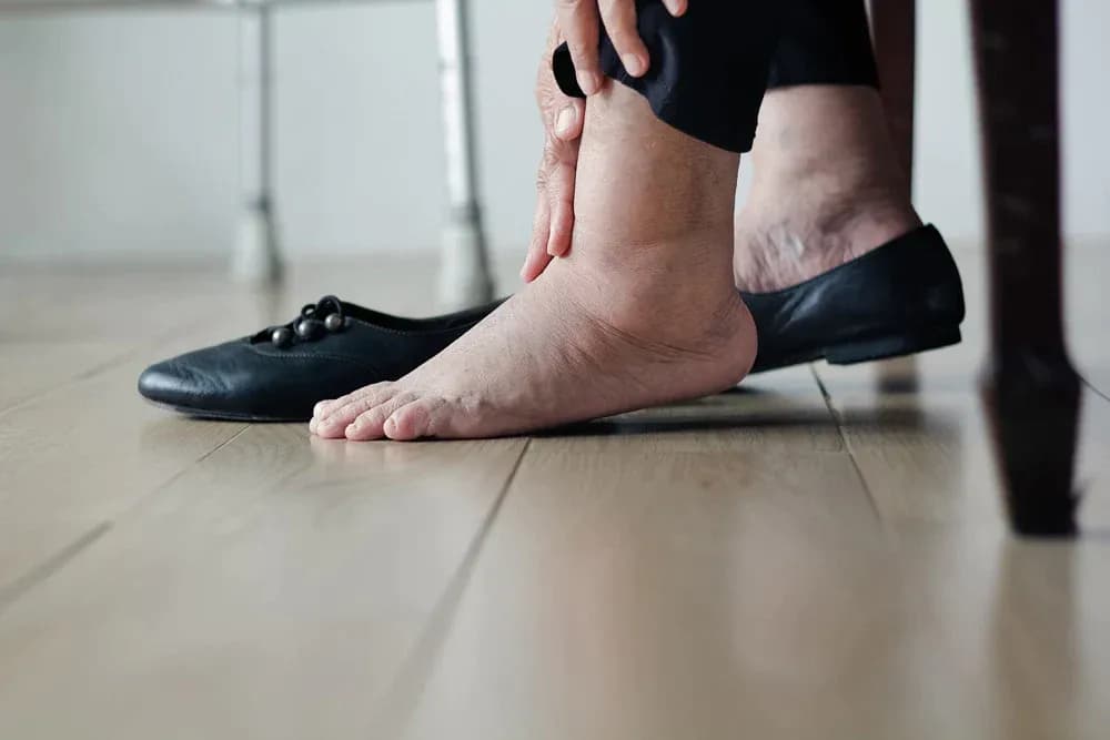 how-to-relieve-swollen-ankles-oak-tree-mobility