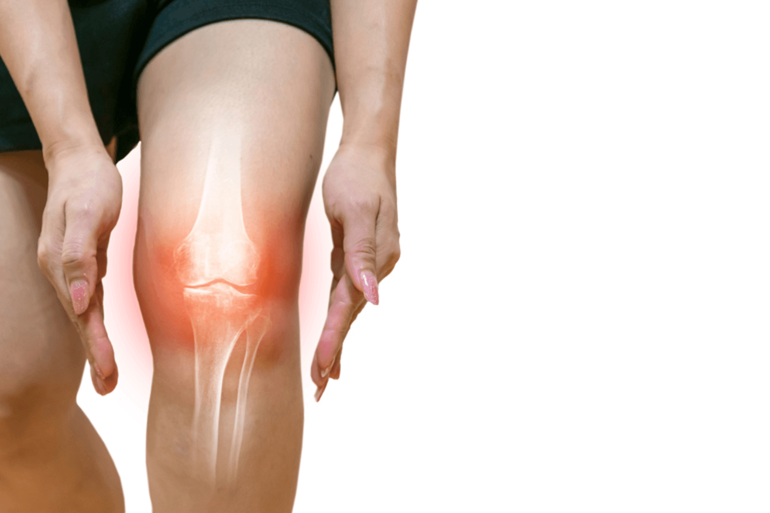 Knee joints support