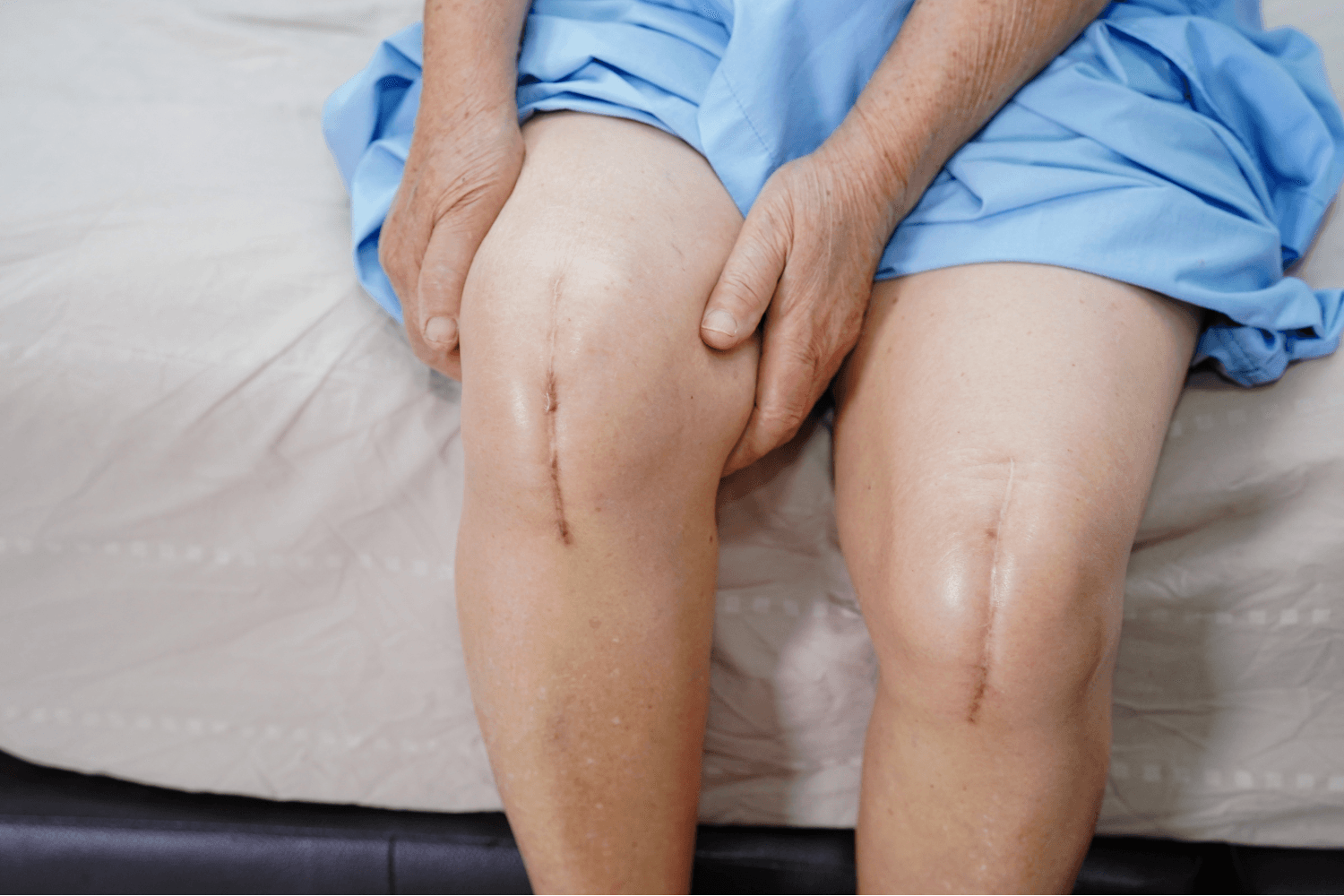 Knee Replacement surgery